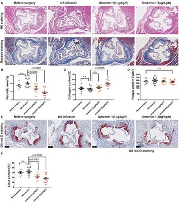 Omentin-1 Modulates Macrophage Function via Integrin Receptors αvβ3 and αvβ5 and Reverses Plaque Vulnerability in Animal Models of Atherosclerosis